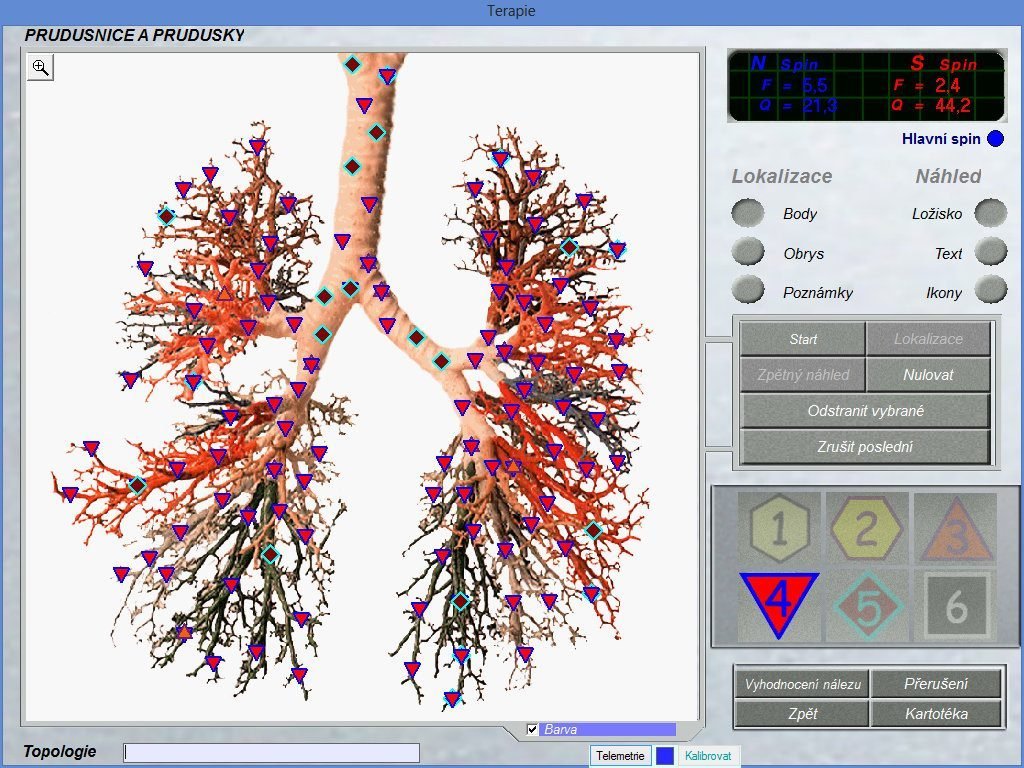 Cu L Es La Diferencia Entre Diacom Nls Old Y Diacom Vector Nls Nls Vector Vector Nls Scan